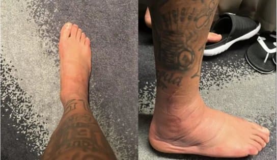 Imagem de Neymar posta foto de tornozelo inchado e preocupa torcedores