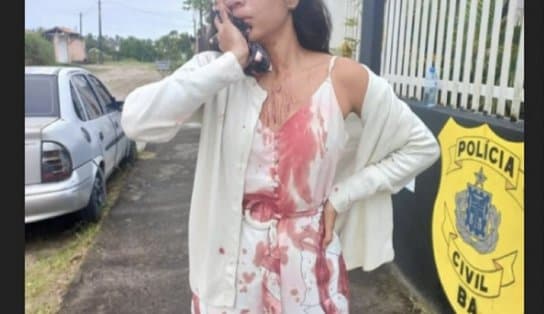 Imagem de Jovem é esfaqueada no rosto enquanto dormia dentro de ônibus; vítima viajava de Recife para Salvador