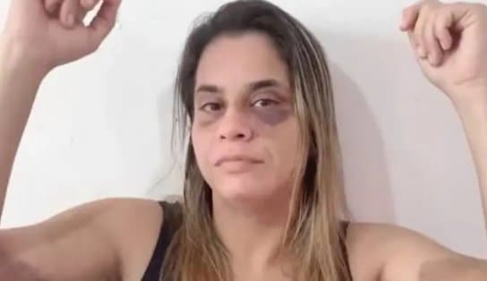 Imagem de Mulher torturada e agredida com espada de samurai fala com exclusividade ao Cidade Aratu; assista