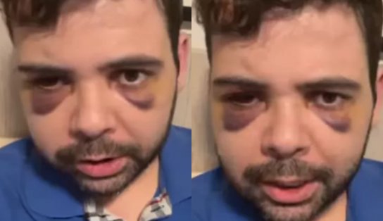 Imagem de Polícia Civil desmente versão de humorista sobre assalto e agressão