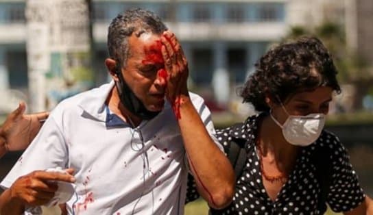 Imagem de Em Recife, dois homens levam tiros de borracha durante protestos por vacinas e perdem parte da visão; vítimas iam para o trabalho