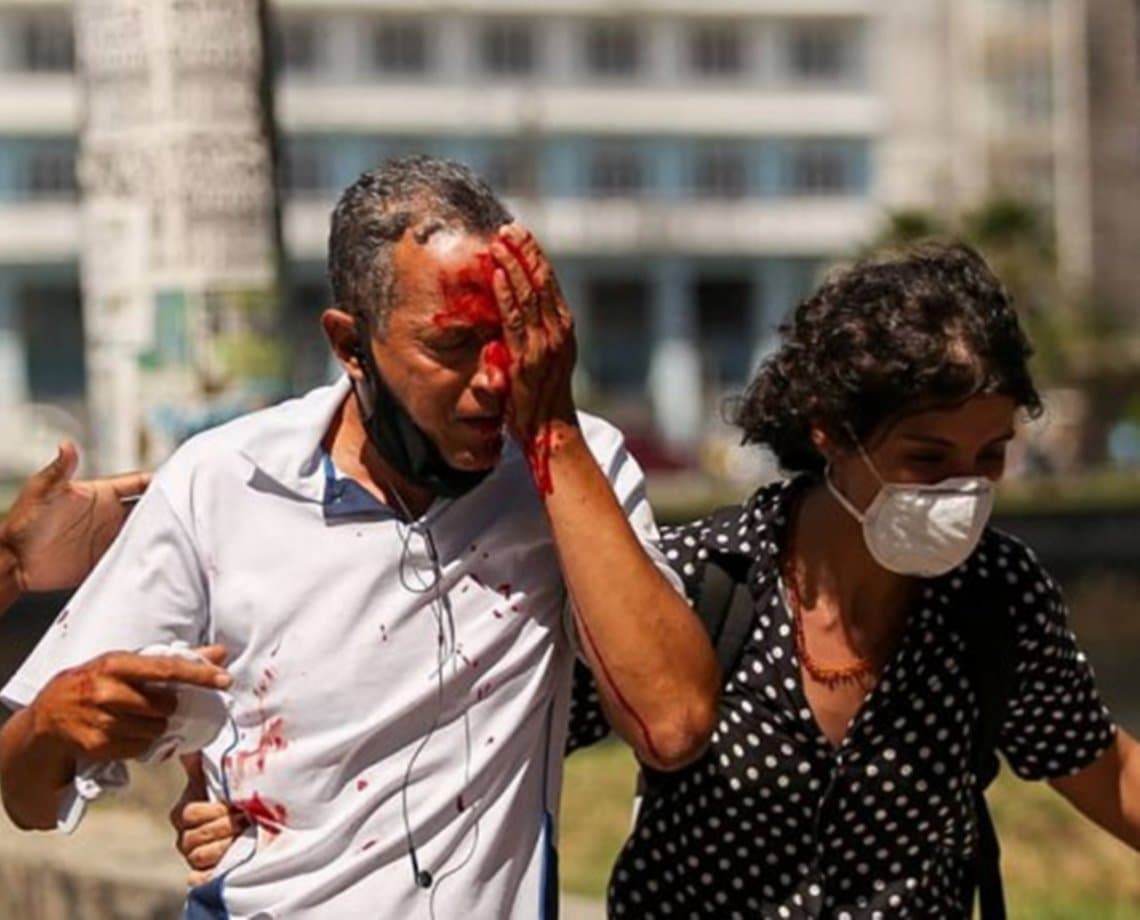 Em Recife, dois homens levam tiros de borracha durante protestos por vacinas e perdem parte da visão; vítimas iam para o trabalho