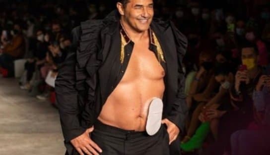 Imagem de Luciano Szafir desfila na São Paulo Fashion Week com bolsa de estomia: "Não define ninguém"