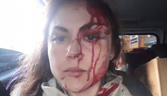 Imagem de VÍDEO: Procuradora é agredida por colega após abrir processo por assédio moral e fica com rosto ensaguentado